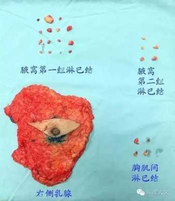 孕期乳房出血怎么回事(孕期乳房出血怎么回事儿) 第1张 孕期乳房出血怎么回事(孕期乳房出血怎么回事儿) 第1张