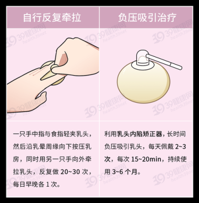 乳头内陷孕期怎么治疗(乳头内陷孕期怎么治疗好) 第1张 乳头内陷孕期怎么治疗(乳头内陷孕期怎么治疗好) 第1张