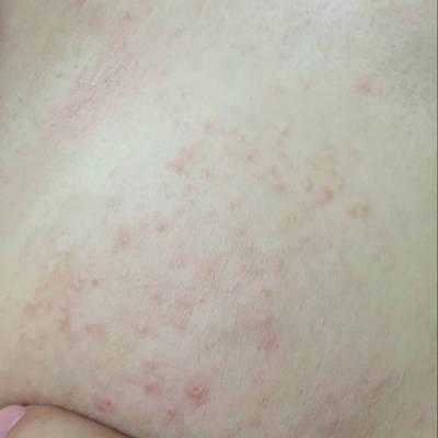 怀孕期间奶头痒(怀孕中期乳头痒怎么回事) 第2张 怀孕期间奶头痒(怀孕中期乳头痒怎么回事) 第2张