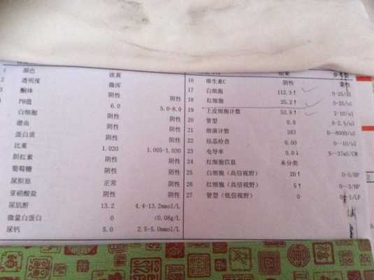 孕期尿常规白细胞偏高(孕妇尿检白细胞、细菌、鳞状上皮细胞偏高) 第2张 孕期尿常规白细胞偏高(孕妇尿检白细胞、细菌、鳞状上皮细胞偏高) 第2张