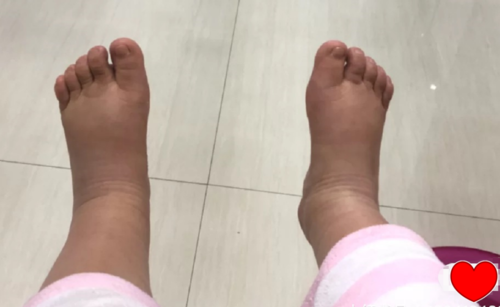 孕期脚变大能恢复吗(孕期脚变大会恢复吗) 第2张 孕期脚变大能恢复吗(孕期脚变大会恢复吗) 第2张