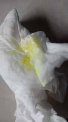 孕期溢乳是什么颜色(孕期溢乳是什么颜色的) 第3张 孕期溢乳是什么颜色(孕期溢乳是什么颜色的) 第3张