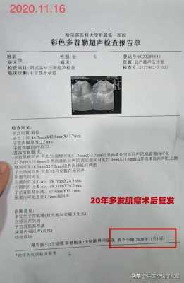 怀孕后检查出子宫肌瘤有影响吗,怀孕期间查出子宫肌瘤危险吗 第1张 怀孕后检查出子宫肌瘤有影响吗,怀孕期间查出子宫肌瘤危险吗 第1张