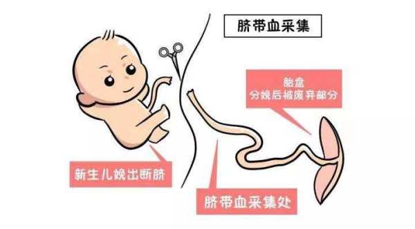 脐带血保留有什么用,胎儿脐带血有什么用呢 第2张 脐带血保留有什么用,胎儿脐带血有什么用呢 第2张