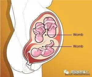 子宫双附件是什么,双子宫胎儿都比较小吗正常吗 第1张 子宫双附件是什么,双子宫胎儿都比较小吗正常吗 第1张