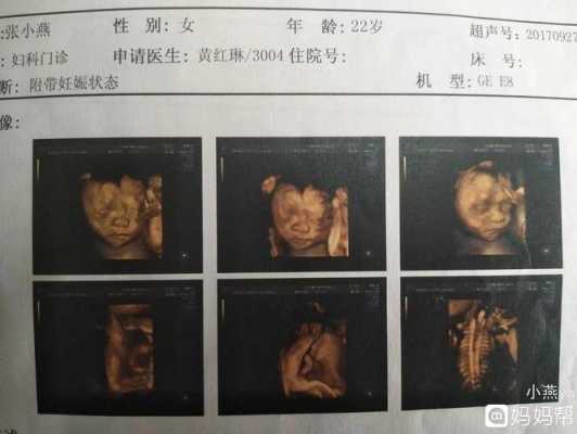 有孕期只脸胖生男孩(有孕期只脸胖生男孩还是女孩) 第1张 有孕期只脸胖生男孩(有孕期只脸胖生男孩还是女孩) 第1张