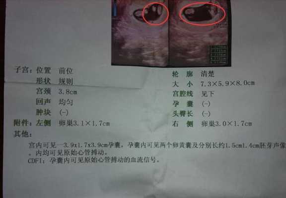 孕期怀男孩有那些征兆(孕期怀男孩有那些征兆吗) 第2张 孕期怀男孩有那些征兆(孕期怀男孩有那些征兆吗) 第2张