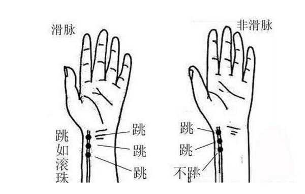 孕期脉搏快是什么原因(孕期脉搏快是什么原因有哪些) 第1张 孕期脉搏快是什么原因(孕期脉搏快是什么原因有哪些) 第1张