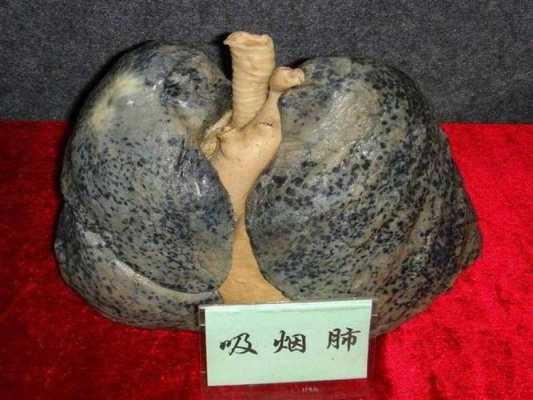 促进胎儿肺成熟的针多少钱(孕37周可以打胎儿肺部成熟的针吗) 第1张 促进胎儿肺成熟的针多少钱(孕37周可以打胎儿肺部成熟的针吗) 第1张