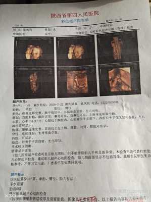 胎儿4个月4维彩超图(4维彩超多少钱) 第2张 胎儿4个月4维彩超图(4维彩超多少钱) 第2张