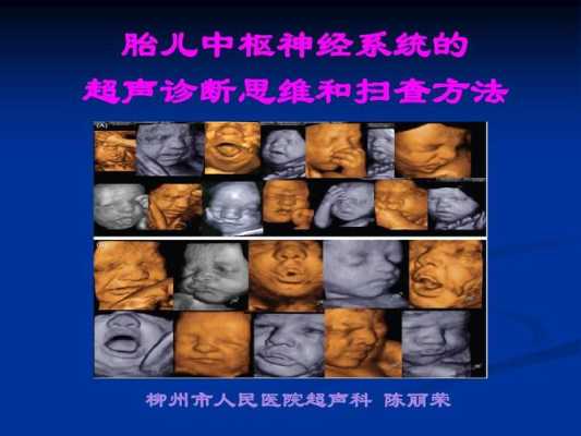 胎儿神经系统发育异常的表现(胎儿神经系统发育异常的表现) 第1张 胎儿神经系统发育异常的表现(胎儿神经系统发育异常的表现) 第1张
