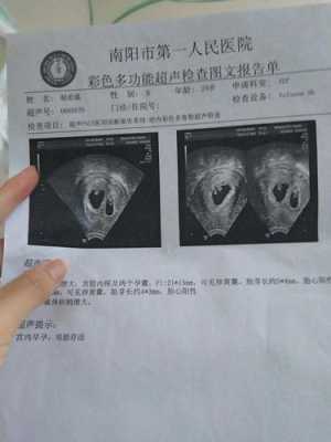 双胞胎宝宝成长记录文字,双胞胎六个月胎儿图片  第1张