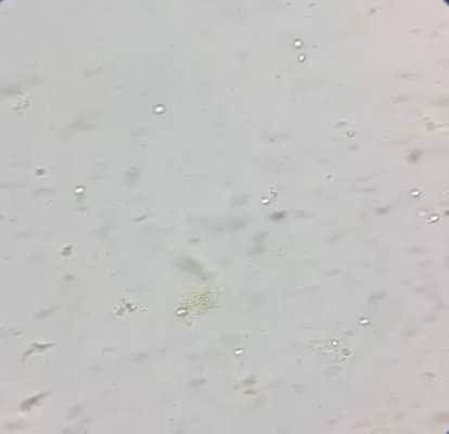 孕期有霉菌是生女孩吗(孕期有霉菌是生女孩吗还是男孩) 第1张 孕期有霉菌是生女孩吗(孕期有霉菌是生女孩吗还是男孩) 第1张