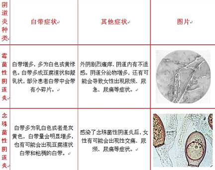 孕期有霉菌是生女孩吗(孕期有霉菌是生女孩吗还是男孩) 第3张 孕期有霉菌是生女孩吗(孕期有霉菌是生女孩吗还是男孩) 第3张