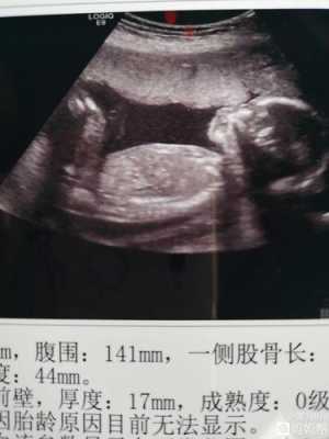 四个月胎儿图彩超图片（四个月胎儿图彩超图片大全）  第2张