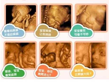做四维彩超对胎儿有影响吗(做四维彩超对胎儿有影响吗) 第1张 做四维彩超对胎儿有影响吗(做四维彩超对胎儿有影响吗) 第1张