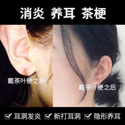 粘连带会在孕期撑开吗(耳环戴不进耳洞怎么办) 第1张 粘连带会在孕期撑开吗(耳环戴不进耳洞怎么办) 第1张