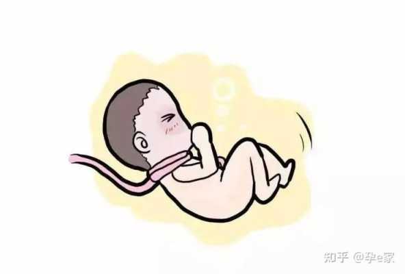 23周胎儿脐带绕颈一周怎么办(23周胎儿脐带绕颈一周怎么办?) 第2张 23周胎儿脐带绕颈一周怎么办(23周胎儿脐带绕颈一周怎么办?) 第2张