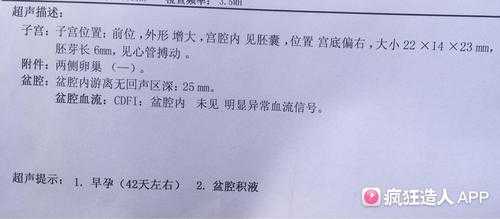 怀孕三个月感冒对胎儿有影响吗(怀孕中期感冒了对胎儿有影响吗?怀孕20周感冒了,吃感冒药对胎儿有影响吗) 第2张 怀孕三个月感冒对胎儿有影响吗(怀孕中期感冒了对胎儿有影响吗?怀孕20周感冒了,吃感冒药对胎儿有影响吗) 第2张