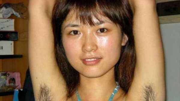 怀孕了体毛很旺盛正常吗,孕期毛发旺盛怎么办  第2张