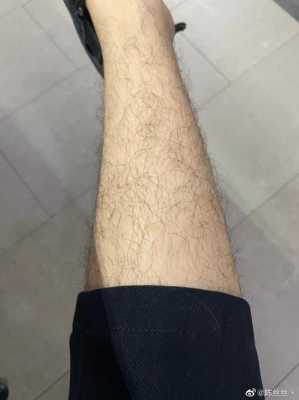 怀孕了体毛很旺盛正常吗,孕期毛发旺盛怎么办  第3张