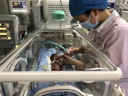 新生儿第一天注意事项?刚刚出生的宝宝要注意什么,新生胎儿图片真实 第3张 新生儿第一天注意事项?刚刚出生的宝宝要注意什么,新生胎儿图片真实 第3张