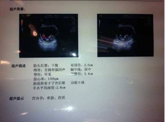 高危胎儿检查(高危胎儿检查是什么意思) 第2张 高危胎儿检查(高危胎儿检查是什么意思) 第2张