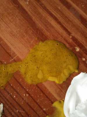 胎儿不排便(新生儿12小时没有大便这种情况正常的吗) 第2张 胎儿不排便(新生儿12小时没有大便这种情况正常的吗) 第2张