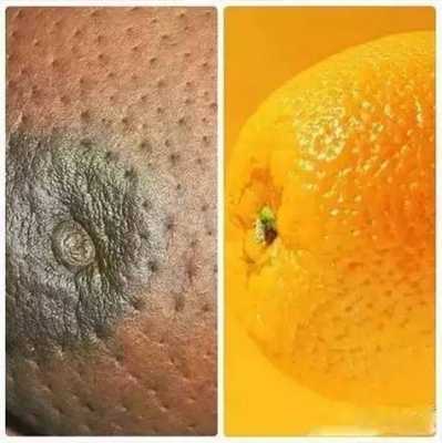 孕期乳房按摩后乳晕两侧发黑正常吗,怀孕期间乳晕的变化是什么 第1张 孕期乳房按摩后乳晕两侧发黑正常吗,怀孕期间乳晕的变化是什么 第1张