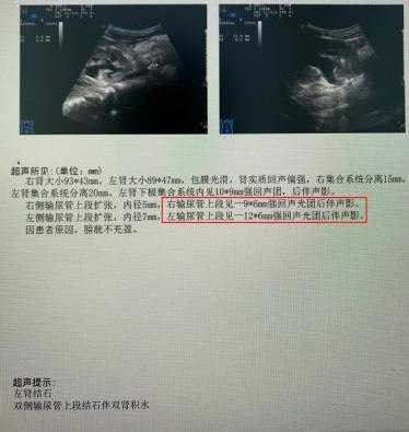 侧胎儿体重(b超体重跟胎儿实际体重相差多少) 第2张 侧胎儿体重(b超体重跟胎儿实际体重相差多少) 第2张