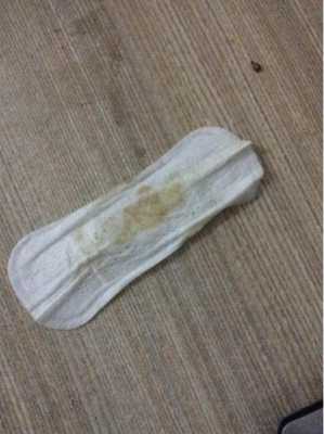 怀孕期白带发黄有异味（孕期白带发黄是怎么回事）  第3张