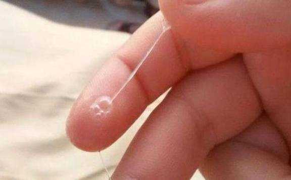 怀孕三个月有白带正常吗?一天还挺多, 第3张 怀孕三个月有白带正常吗?一天还挺多, 第3张