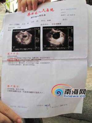 b超单子上RI是什么意思,胎儿ri值正常范围 第2张 b超单子上RI是什么意思,胎儿ri值正常范围 第2张