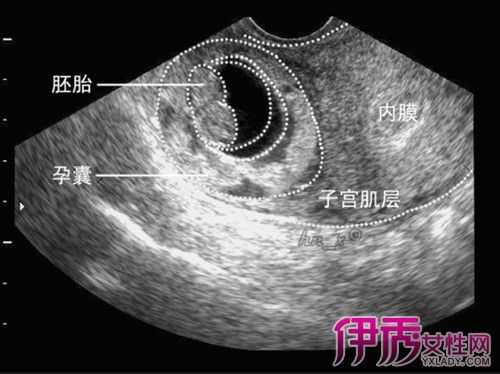 胚芽就是胎儿吗(孕早期胚芽是什么) 第2张 胚芽就是胎儿吗(孕早期胚芽是什么) 第2张