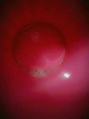 孕期吐的红粘稠是啥(孕妇吐红色粘稠液体) 第2张 孕期吐的红粘稠是啥(孕妇吐红色粘稠液体) 第2张
