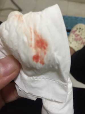孕期出血是怎么回事,孕期有血是怎么回事 第3张 孕期出血是怎么回事,孕期有血是怎么回事 第3张