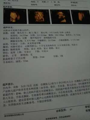 胎儿彩超ac（四维fl是什么意思啊）  第2张