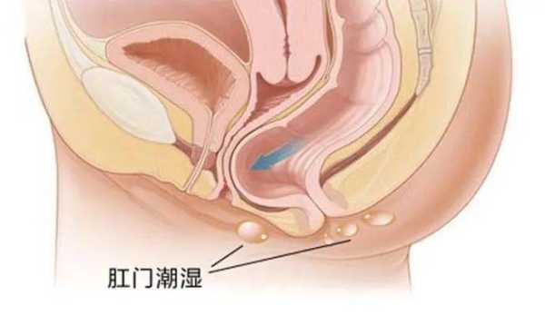 怀孕屁股痒怎么回事,孕妇一到晚上肛门瘙痒 第1张 怀孕屁股痒怎么回事,孕妇一到晚上肛门瘙痒 第1张