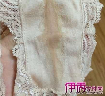 孕期白带乳白色正常吗（怀孕流白色液体正常吗？需要怎么做帮助自己）  第1张