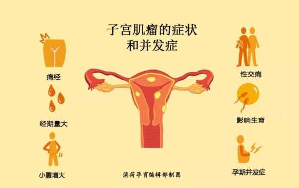 怀孕期间长了子宫肌瘤(怀孕后检查出子宫肌瘤有影响吗) 第2张 怀孕期间长了子宫肌瘤(怀孕后检查出子宫肌瘤有影响吗) 第2张