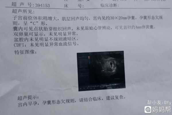 怀孕多少天可以见原始心管搏动,胎儿多久有心管搏动现象  第2张