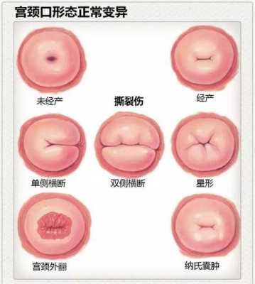 宫颈肥大影响胎儿吗(子宫颈肥大什么意思) 第1张 宫颈肥大影响胎儿吗(子宫颈肥大什么意思) 第1张