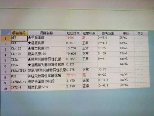 孕期甲胎蛋白参考值(甲胎蛋白值多少算正常) 第2张 孕期甲胎蛋白参考值(甲胎蛋白值多少算正常) 第2张