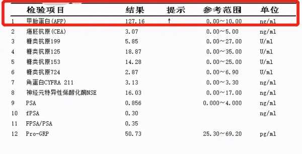 孕期甲胎蛋白参考值(甲胎蛋白值多少算正常) 第1张 孕期甲胎蛋白参考值(甲胎蛋白值多少算正常) 第1张