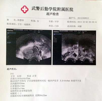 胎儿系统超声检查时间(彩超多长时间可以做一次) 第3张 胎儿系统超声检查时间(彩超多长时间可以做一次) 第3张