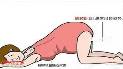 孕妇正常趴床姿势, 第1张 孕妇正常趴床姿势, 第1张