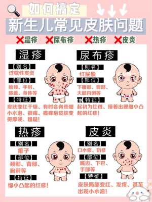 孕期如何预防新生儿湿疹(孕期如何预防新生儿湿疹复发) 第3张 孕期如何预防新生儿湿疹(孕期如何预防新生儿湿疹复发) 第3张