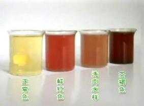 孕期尿偏红色是怎么回事,孕期尿液偏红什么原因引起的 第1张 孕期尿偏红色是怎么回事,孕期尿液偏红什么原因引起的 第1张