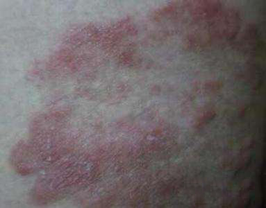 怀孕期腿痒是男孩（怀孕期腿痒是男孩）  第3张