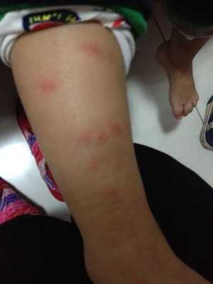 怀孕期腿痒是男孩（怀孕期腿痒是男孩）  第2张